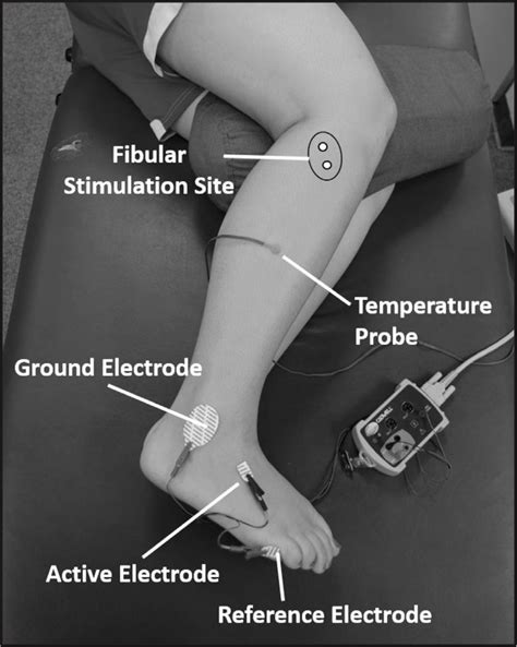 testing nerve conduction velocioty for drop foot|foot drop ncbi.